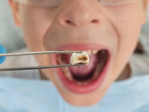 Best Mobile Emergency Dentist in Williamsport, OH