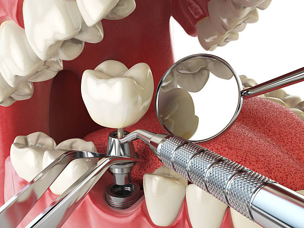 Best Emergency Dental Extractions in Williamsport, OH